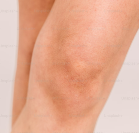 콘드로이친의 모든 것: 종류별 효능과 현명한 선택 가이드