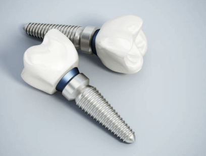 임플란트 후 통증 며칠