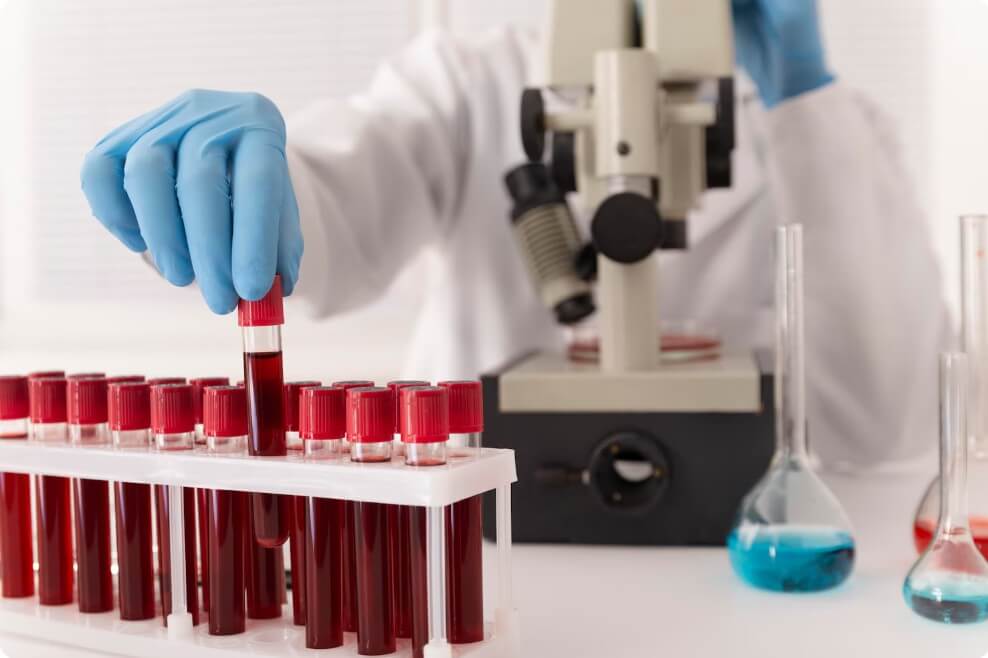 채취한 혈액을 검사하는 의사