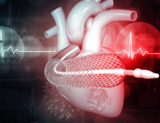 심장판막증 증상 수술 비용 역류 현상 심장판막증에 좋은 음식 / 수술 후 운동