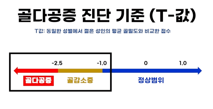 골다공증 진단 기준표