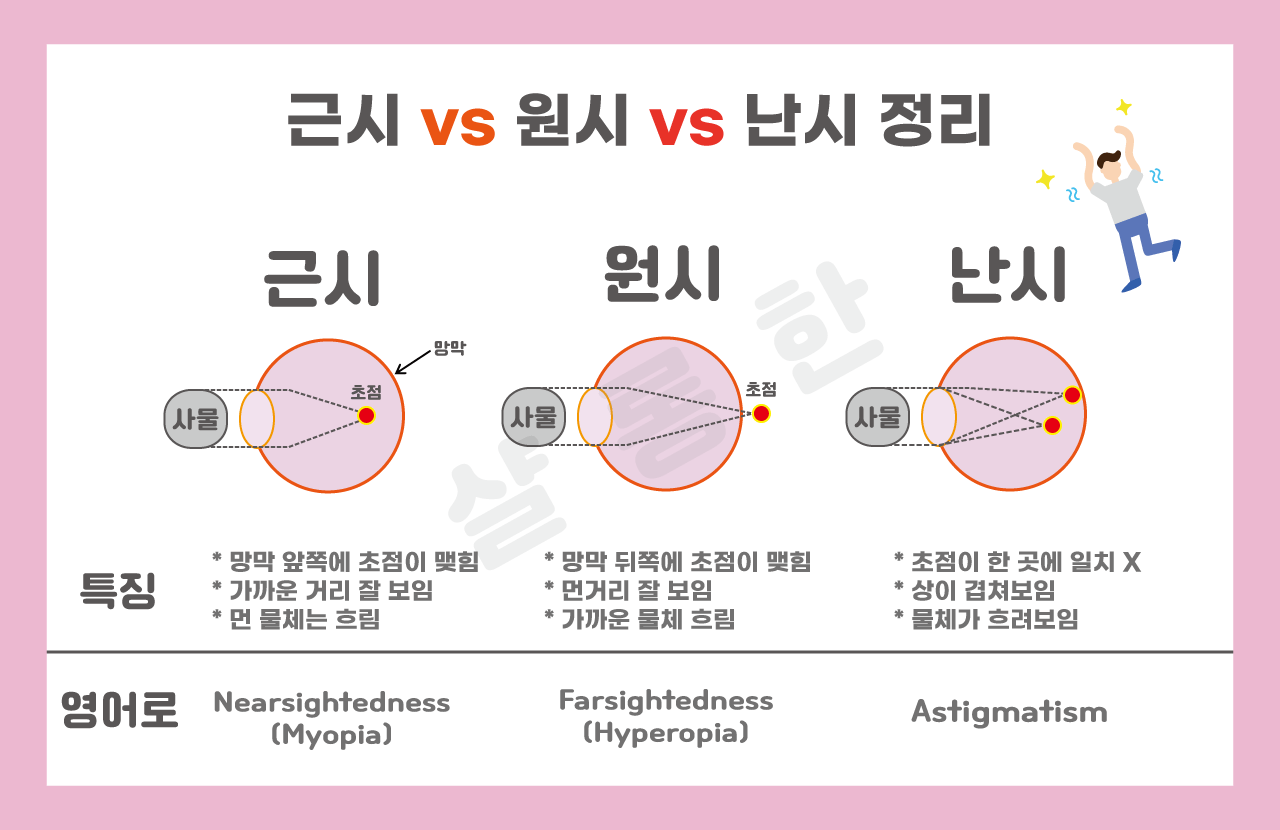 근시-원시-난시-뜻-및-영어로-정리