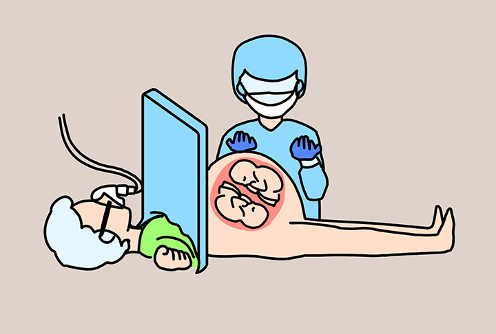 다태임신을-수술하는-의사