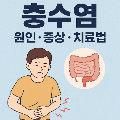 충수염(맹장염) 원인, 증상 및 치료법