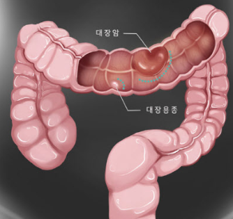 대장
