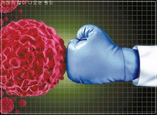 가래가 생기는 원인