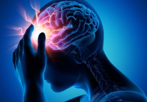 심한 두통 이미지