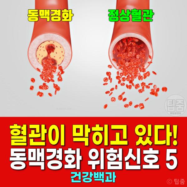 동맥경화 초기증상
