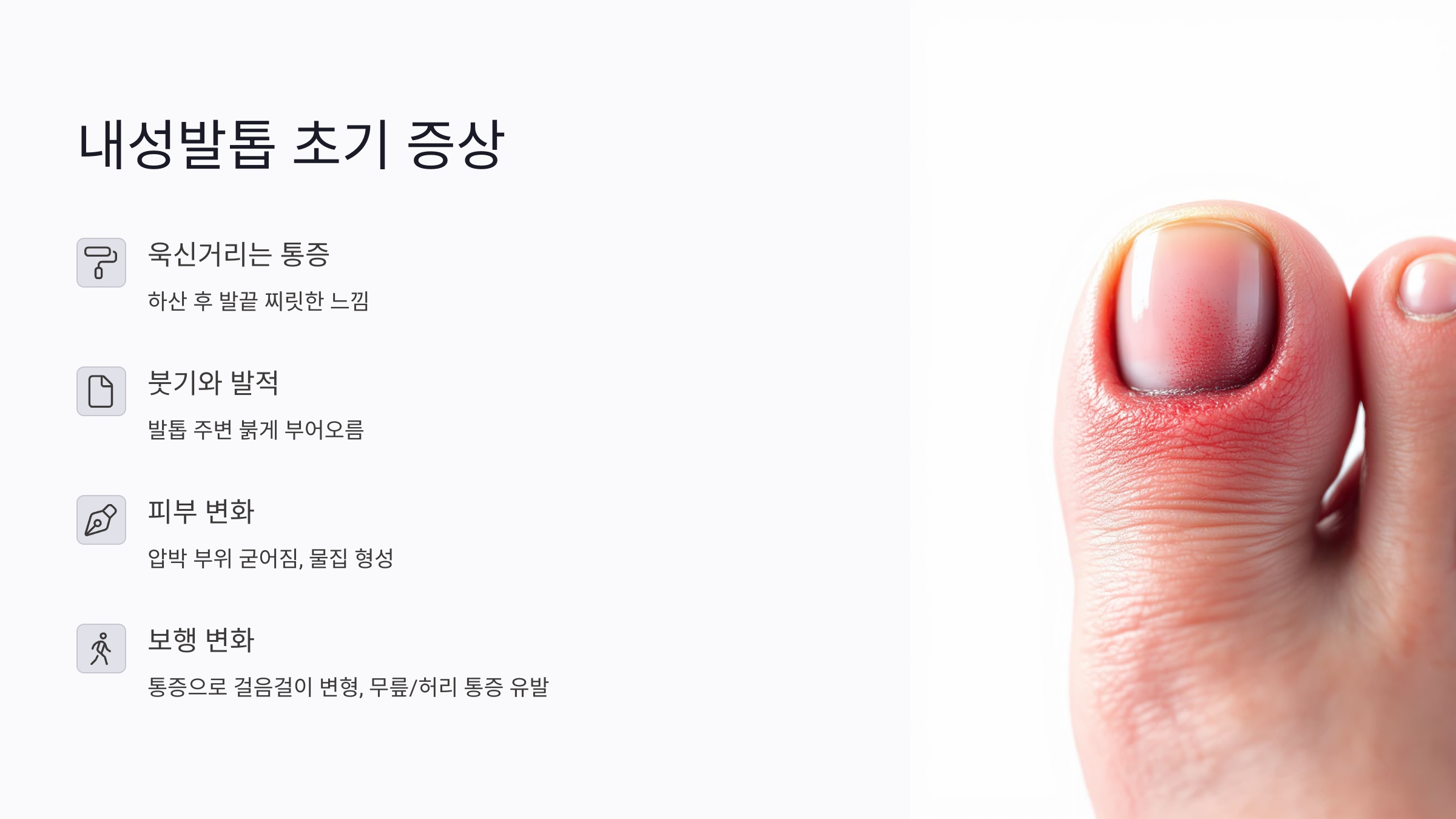 등산 후 발톱 통증은 단순 피로가 아닐 수 있다