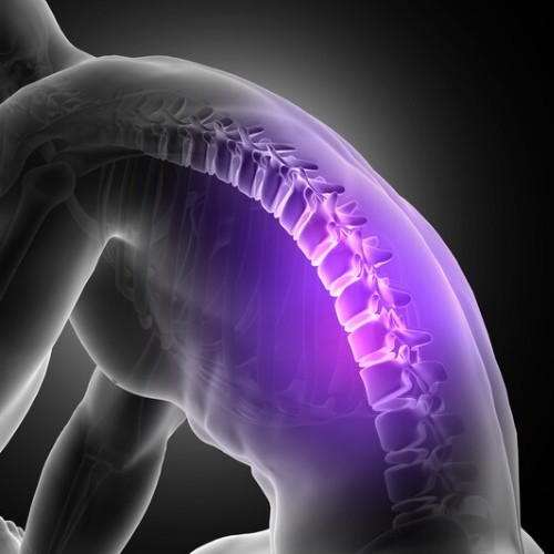 허리가 뻐근하고 땡길 때, 디스크가 아닐 수도