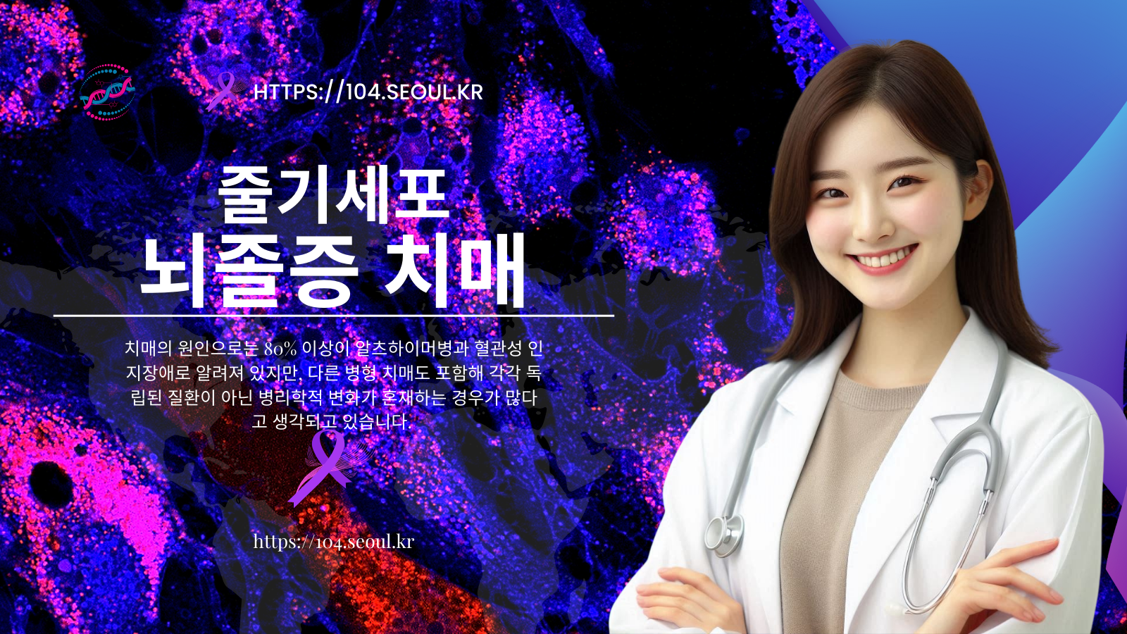 뇌졸중, 치매에 대한 줄기세포 치료에 대하여