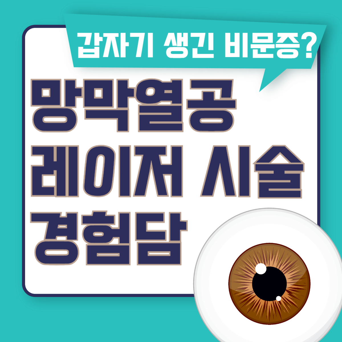 썸네일-망막열공-레이저시술-경험담
