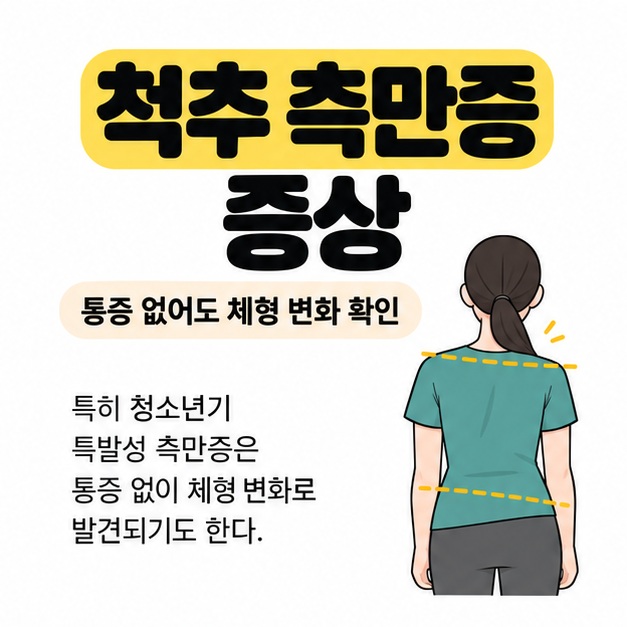 척추 측만증 증상이라는 제목과 함께 옷을 입은 사람의 뒷모습에서 어깨와 허리 높이 차이를 표시하고 통증 없는 체형 변화도 확인하도록 안내하는 그림
