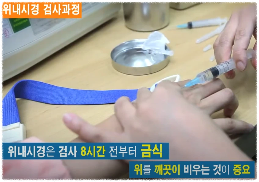 위내시경 금식시간 안내 이미지