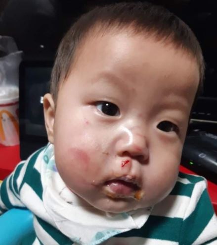 제2의 정인이사건