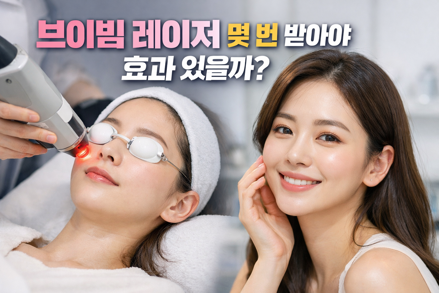 브이빔 레이저