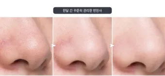 남자 얼굴 피지 제거 화장품 꿀템_5