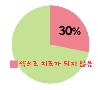 역류성식도염의 PPI 제제(처방약)로 치료가 되지 않는 경우 비율 그래프