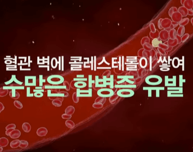 고증혈증 증상 및 자가진단 테스트 바로가기