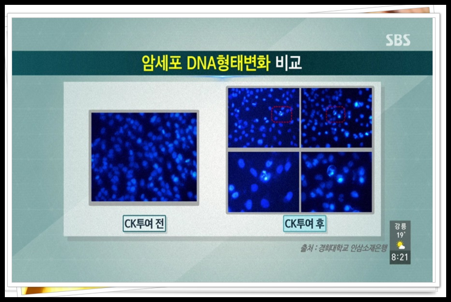 자궁경부암 반응성 세포변화