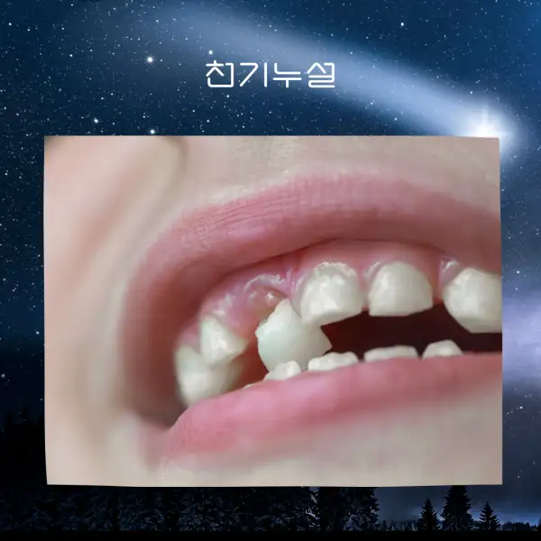 이가 빠지는 꿈해몽