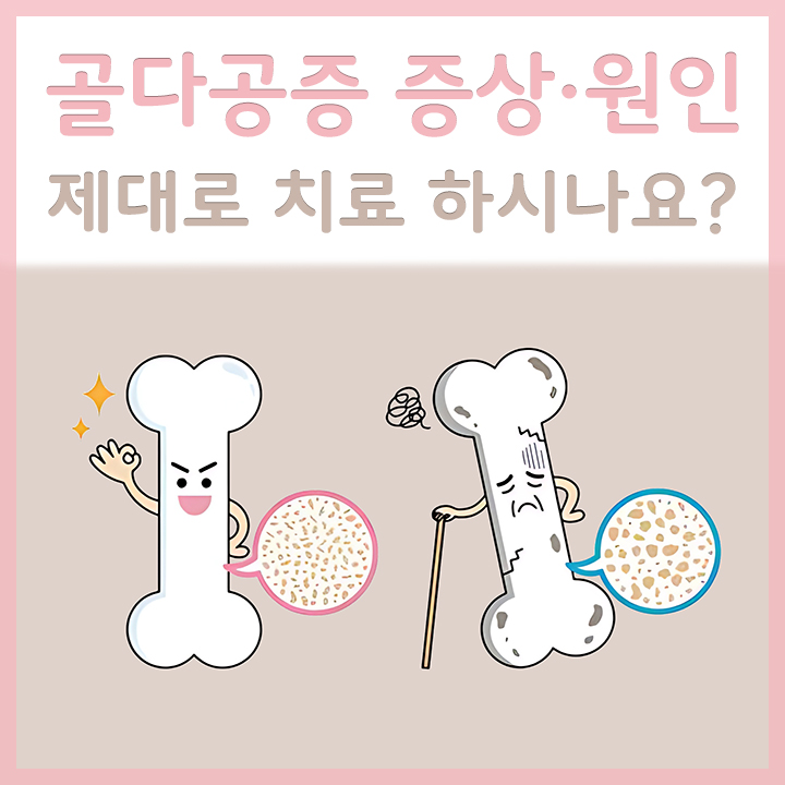 정상적인-뼈와-골다공증의-뼈-비교