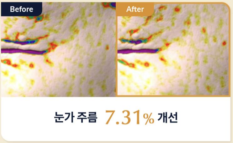 블랙스네일크림효과