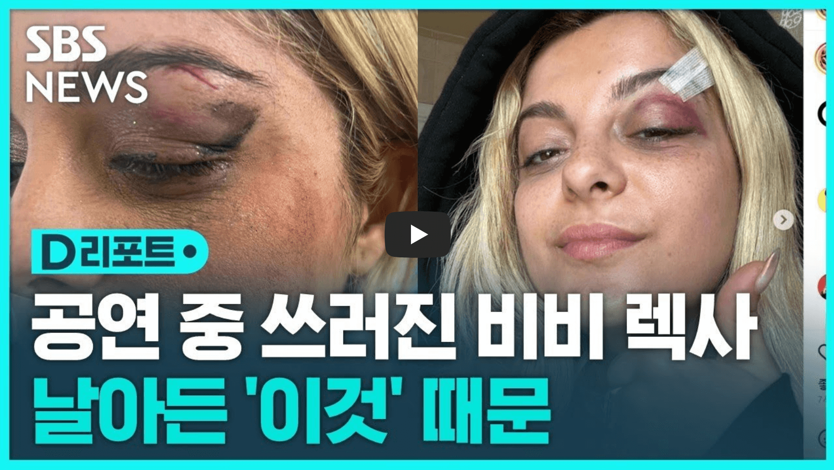 비비렉사가 공연 중 휴대폰 맞고 부상당한 사건 관련 영상의 섬네일