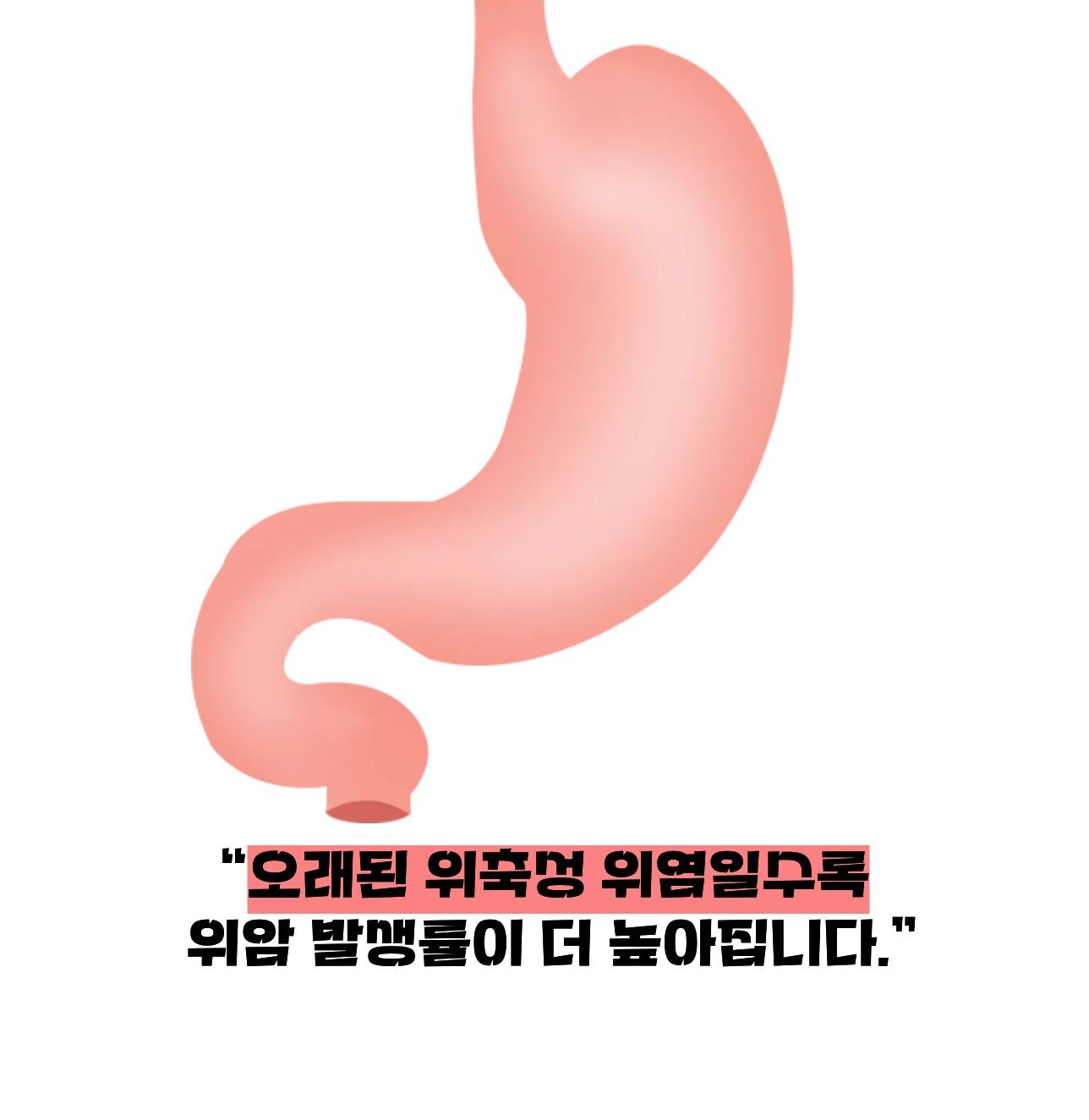 위축성 위염이 암에 걸릴 확률