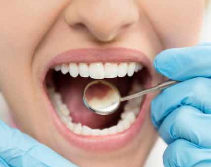 ์ํ๋ํธ ๋ผ์ด์