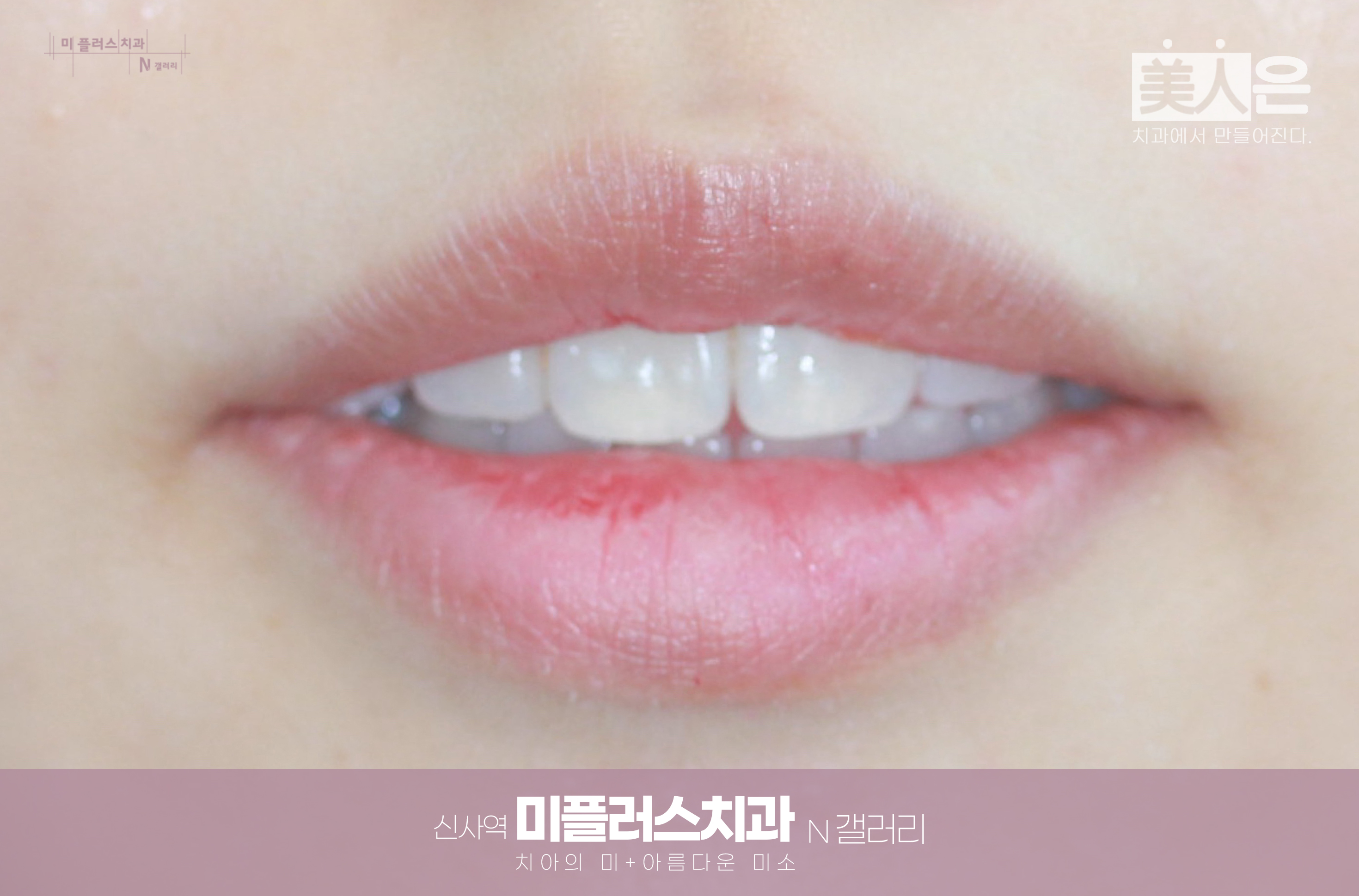 자연스럽게 미소 짓는 입매와 부드러운 입꼬리 모습
