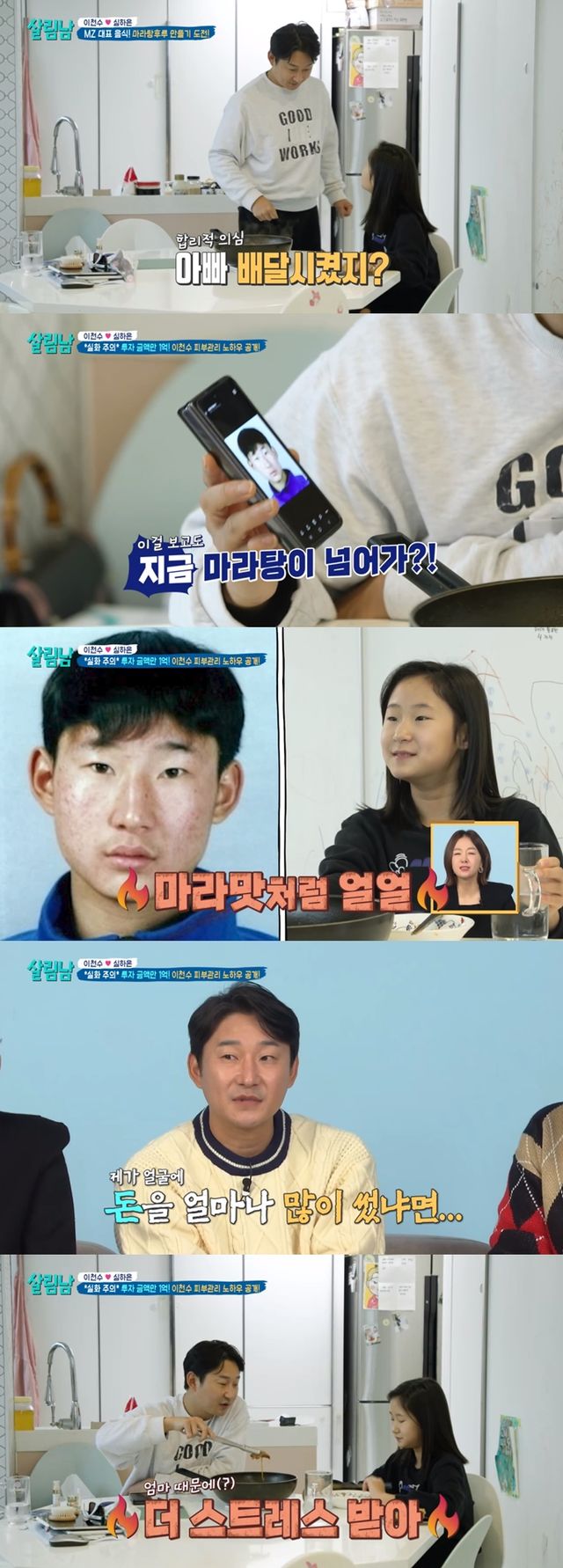 이천수&#44; 여드름 관리 위해 억 단위 투자…