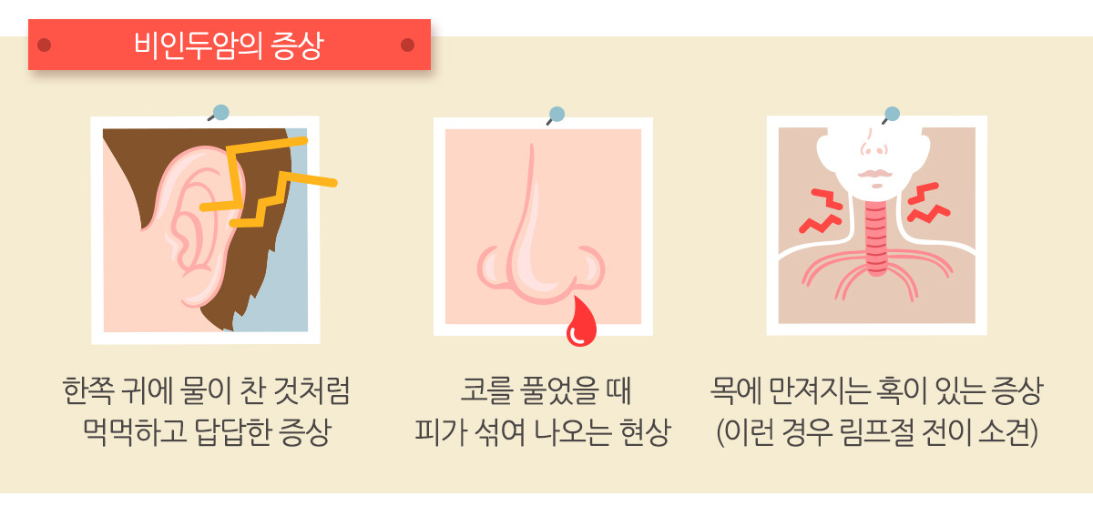비인두암 생존율 증상 검사 원인 예방법 건강정보 암예방 EpsteinBarr 비인두암치료