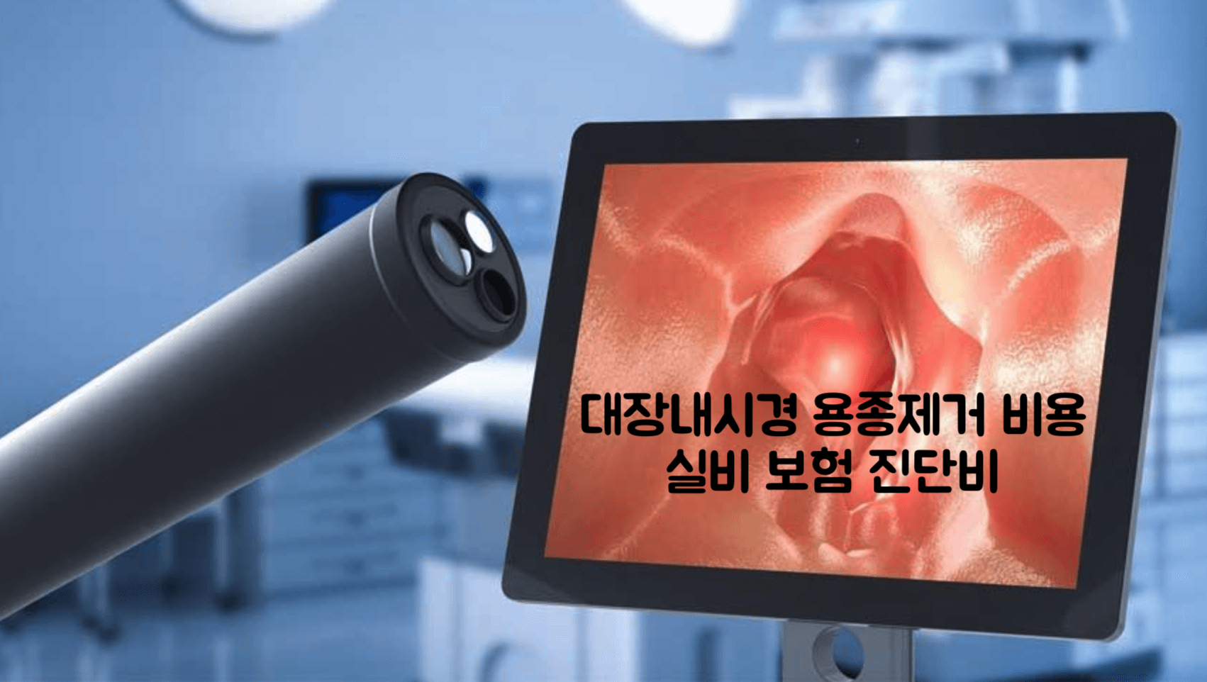 대장내시경 용종제거