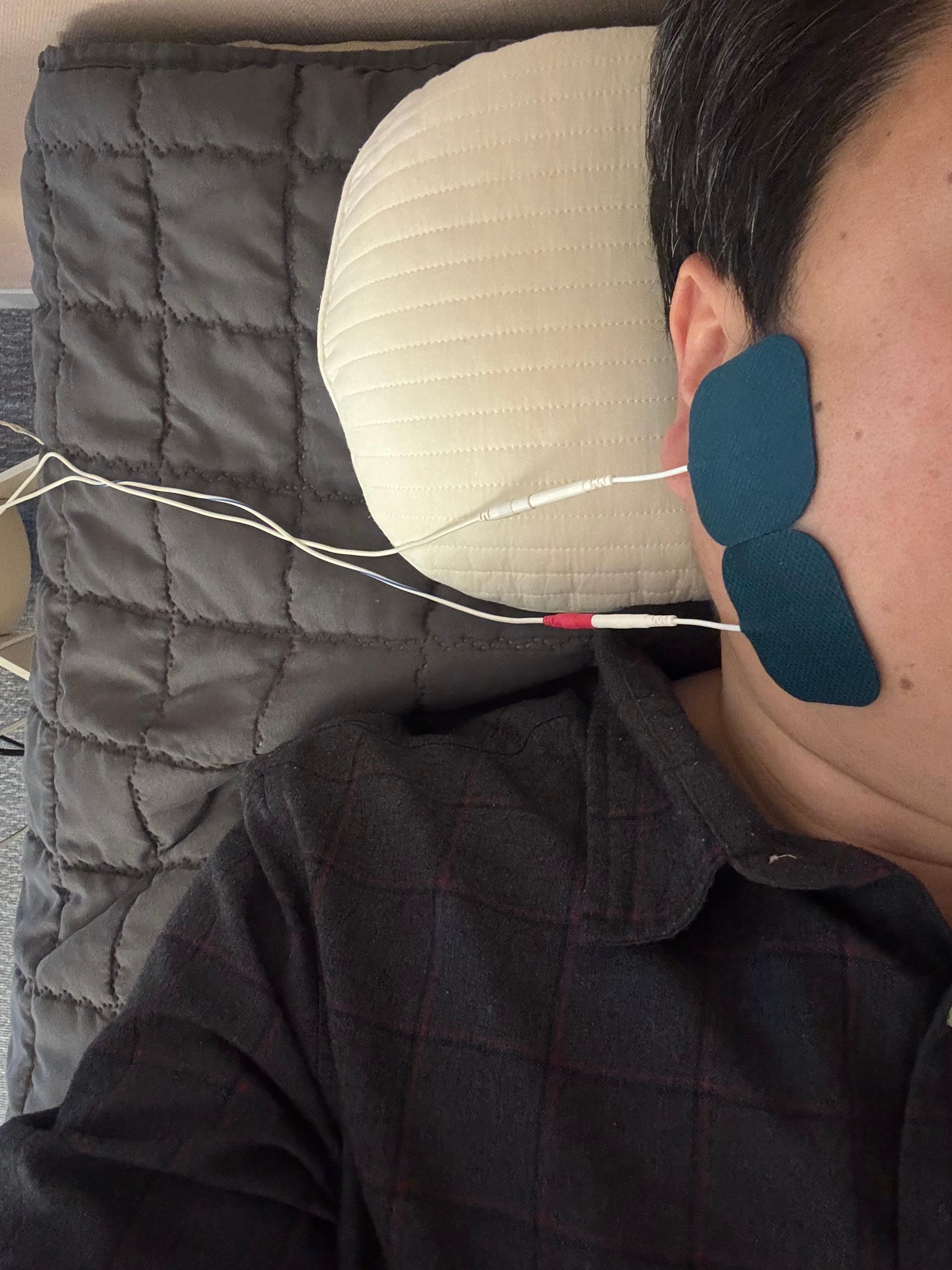 턱관절 물리치료 전기자극