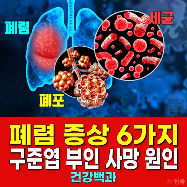 폐렴 증상 폐렴과 독감 차이 구준엽 부인 사망 원인