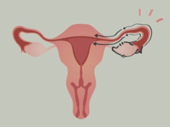 자궁을-형상화한-그림