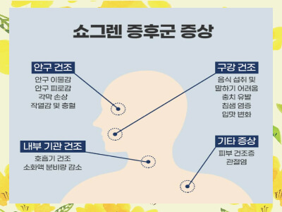 쇼그렌증후군 증상과 치료방법