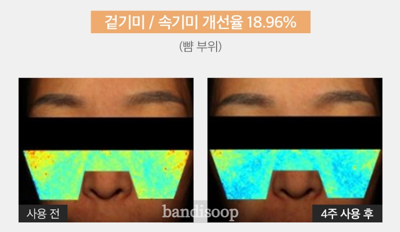 트라넥삼산-크림-약-효능-3