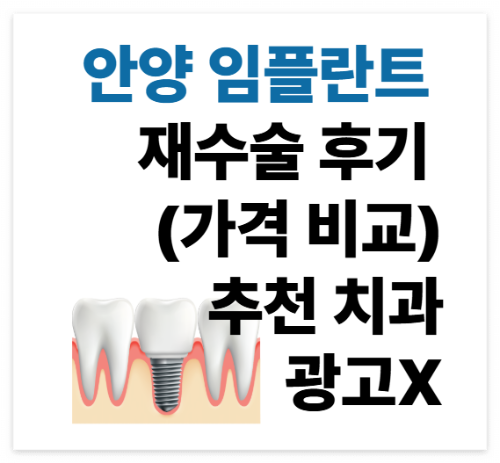 안양 임플란트 재수술 후기 (가격 비교)