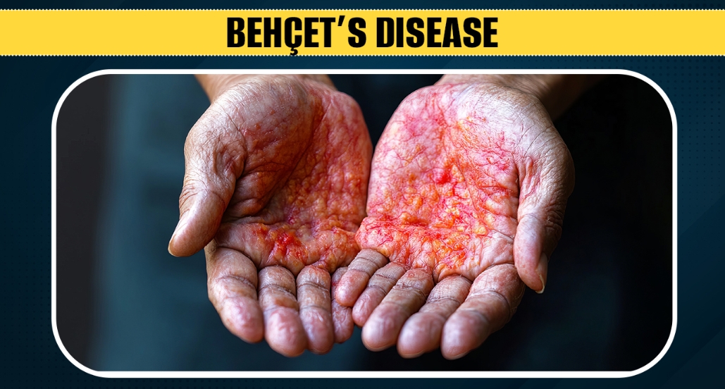 손바닥 등의 피부 병변 모습이 담긴 실제 사진