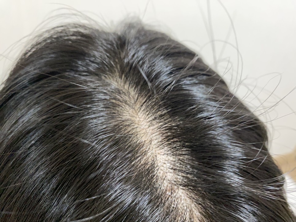 탈모샴푸 후기 찾고계신다면 확인