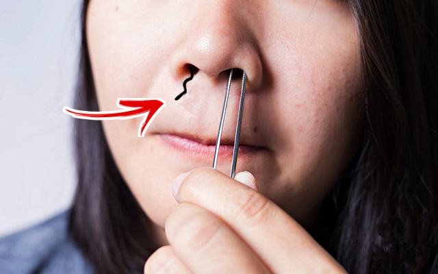 코털 콧털 눈썹 길게 나는 이유,건강