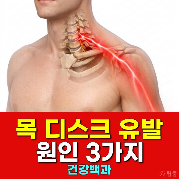 목 디스크 원인