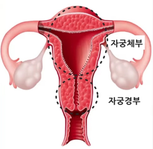 자궁경부