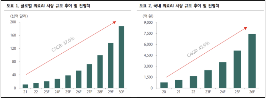 뷰노-치매진단-의료AI-미FDA승인-소개