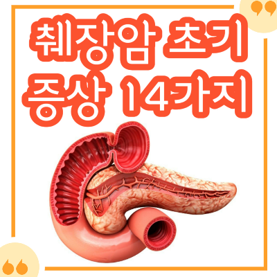췌장암 초기 증상 14가지