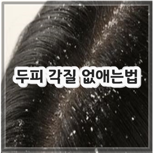 두피 각질 없애는법