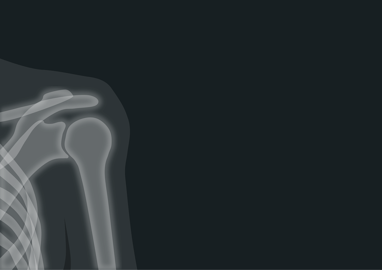 어깨 통증 원인 총정리 : 회전근개 파열&middot;오십견&middot;충돌증후군 차이와 치료법