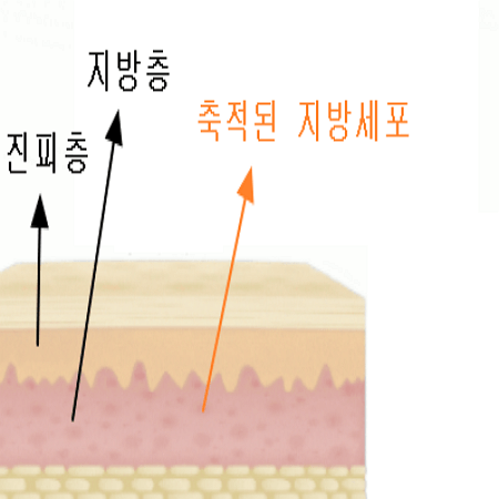 피부층을 구성하는 진피층과 지방층